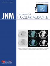 Journal of Nuclear Medicine: 55 (7)