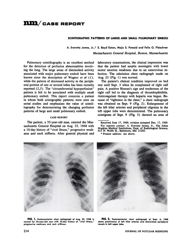 PDF extract preview