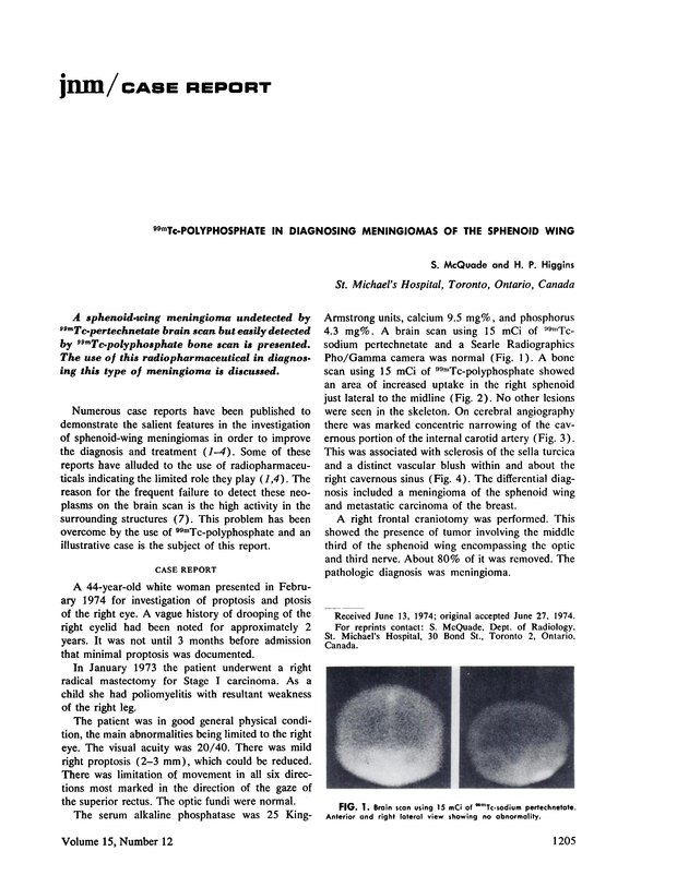 PDF extract preview