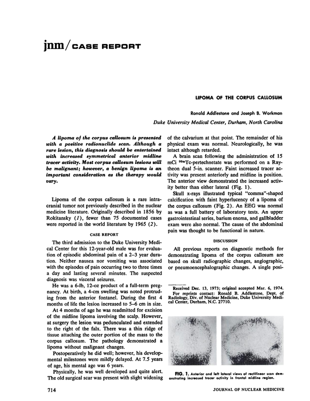 PDF extract preview