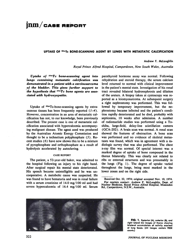PDF extract preview