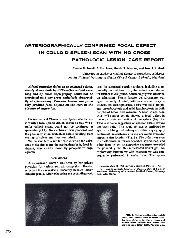 PDF extract preview