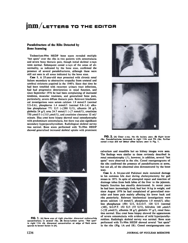 PDF extract preview