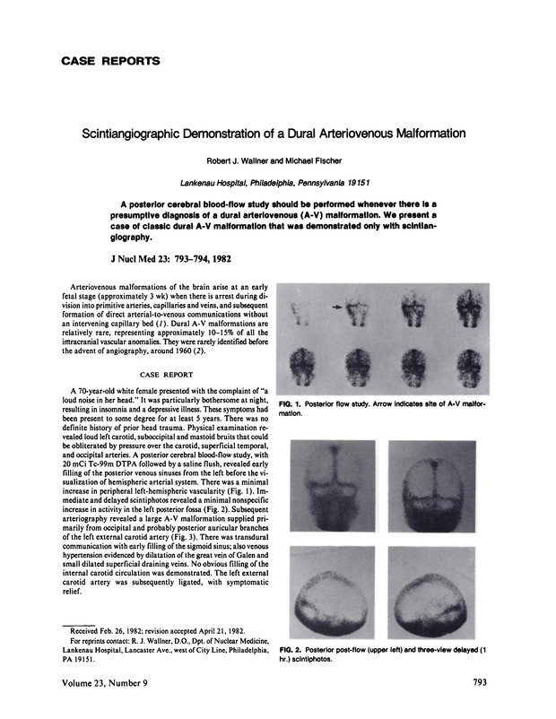 PDF extract preview