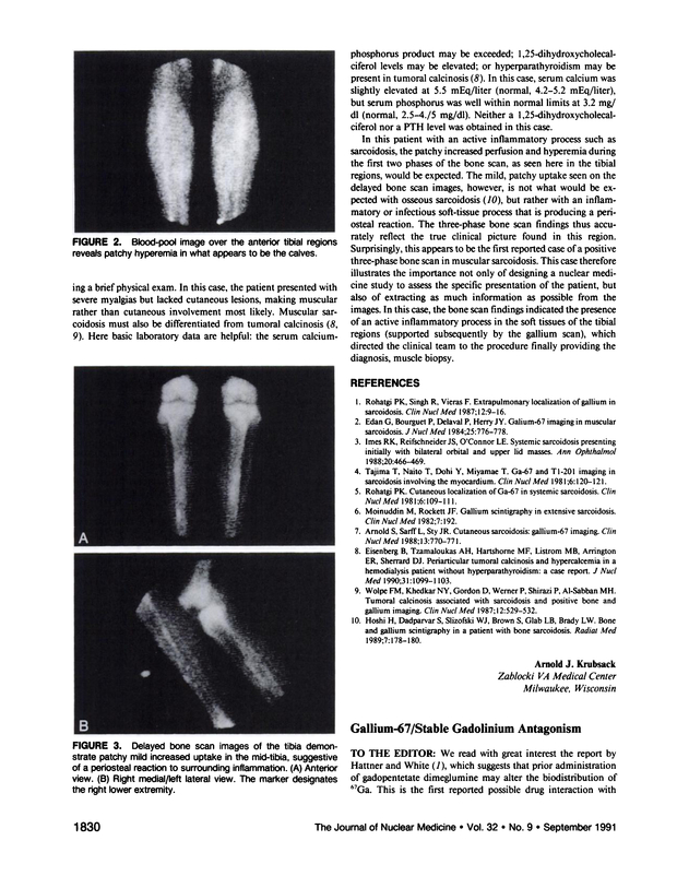 PDF extract preview