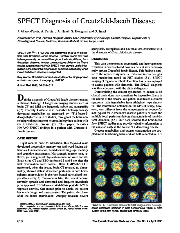 PDF extract preview