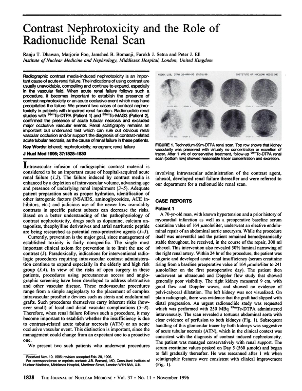 PDF extract preview