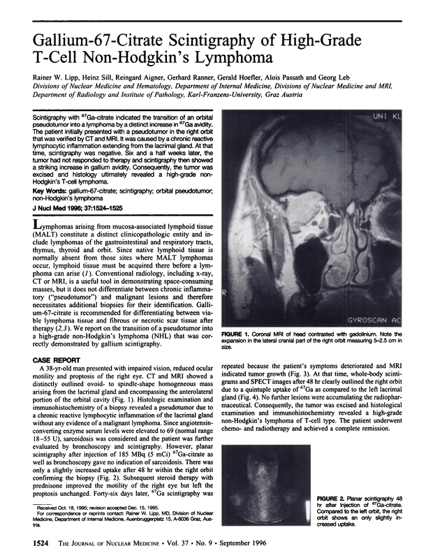 PDF extract preview