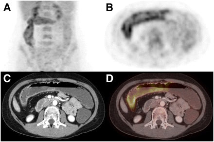 FIGURE 3. 