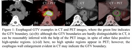 Figure1