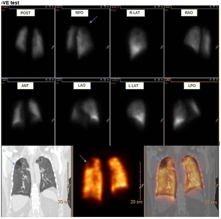 Figure1