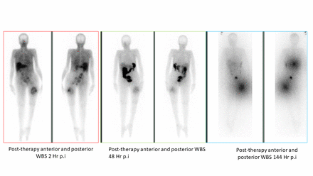 Figure1