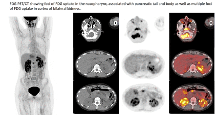 Figure1