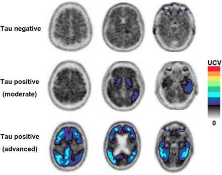 FIGURE 1.