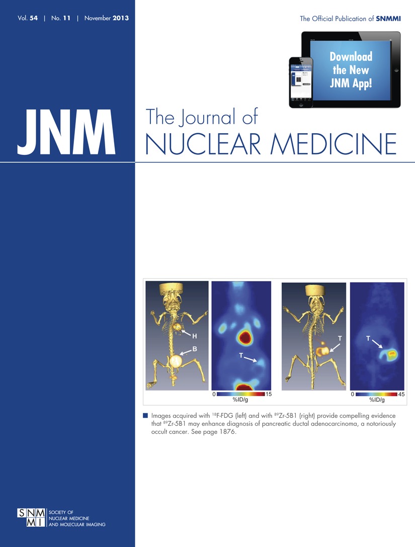 Long Term Hematotoxicity After Peptide Receptor Radionuclide Therapy With 177lu Octreotate Journal Of Nuclear Medicine