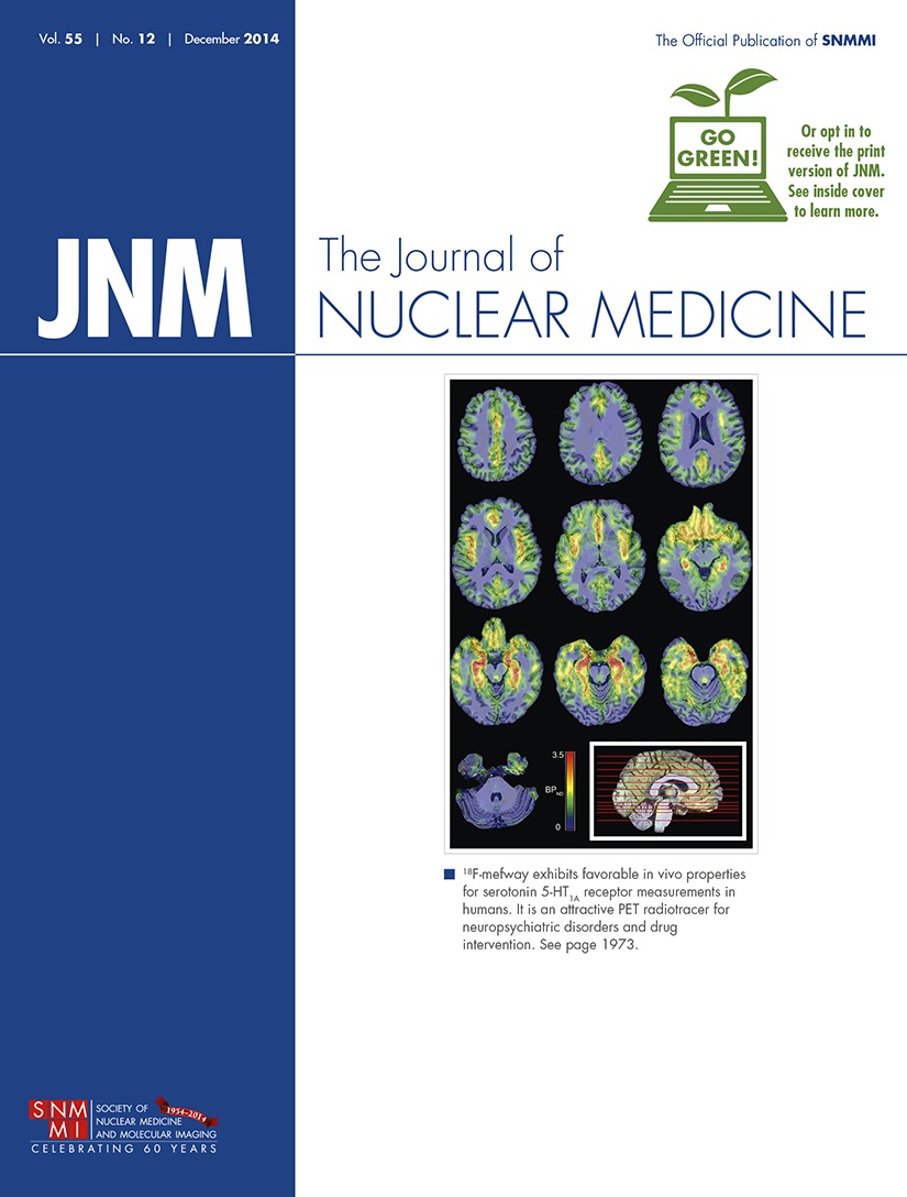 18f Fdg Pet And Perfusion Spect In The Diagnosis Of Alzheimer And Lewy Body Dementias Journal Of Nuclear Medicine