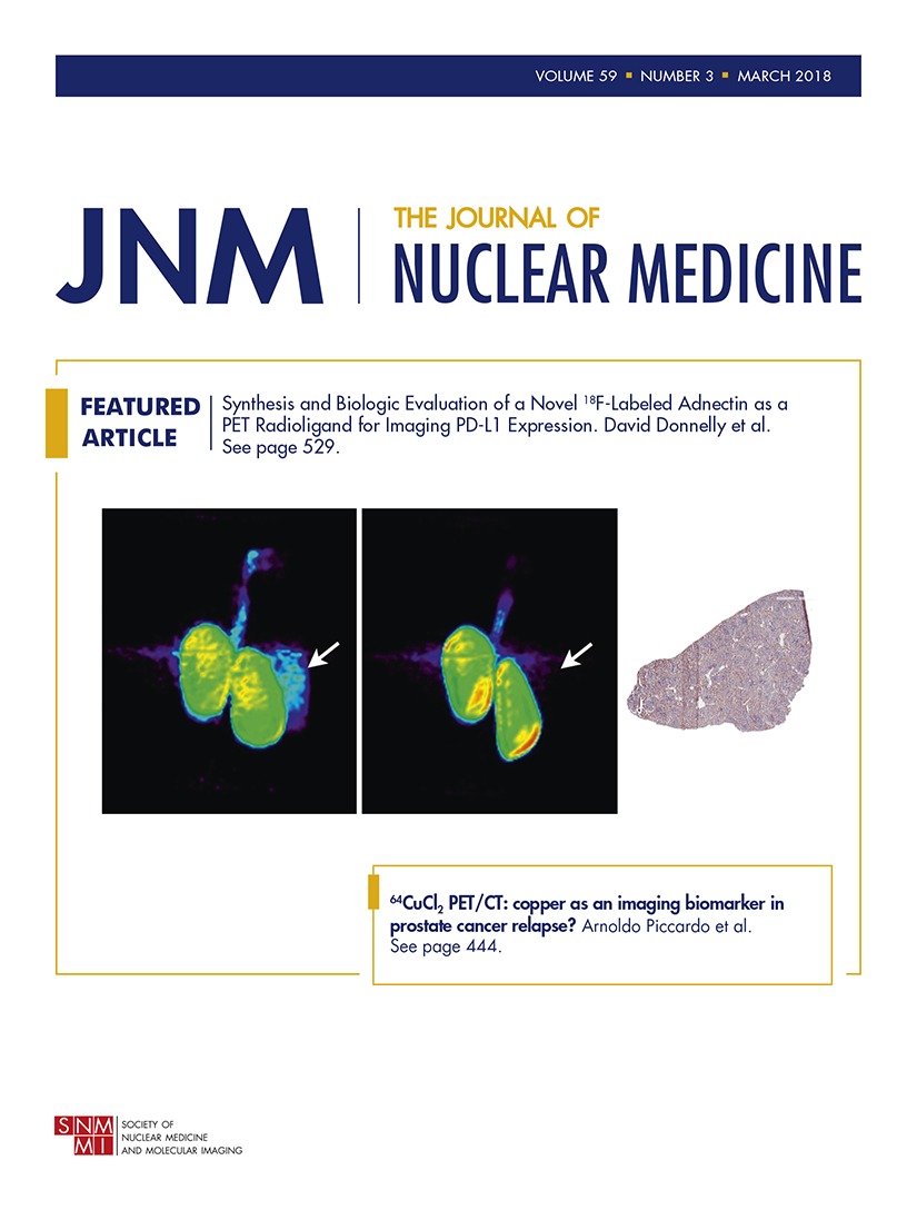 Neuroinflammation Appears Early On Pet Imaging And Then Plateaus In A Mouse Model Of Alzheimer Disease Journal Of Nuclear Medicine