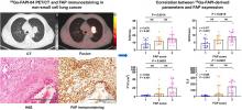 <sup>68</sup>Ga-FAPI-04 PET/CT in Non–Small Cell Lung Cancer: Accurate Evaluation of Lymph Node Metastasis and Correlation with Fibroblast Activation Protein Expression