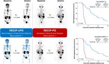 RECIP 1.0 Predicts Progression-Free Survival After [<sup>177</sup>Lu]Lu-PSMA Radiopharmaceutical Therapy in Patients with Metastatic Castration-Resistant Prostate Cancer