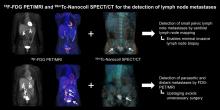 Lymph Node Staging with a Combined Protocol of <sup>18</sup>F-FDG PET/MRI and Sentinel Node SPECT/CT: A Prospective Study in Patients with FIGO I/II Cervical Carcinoma