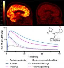 First-in-Human Study of <sup>18</sup>F-SynVesT-2: An SV2A PET Imaging Probe with Fast Brain Kinetics and High Specific Binding