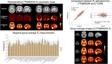 Measurement of Cerebral Perfusion Indices from the Early Phase of [<sup>18</sup>F]MK6240 Dynamic Tau PET Imaging