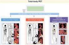 Exploring Vessel Wall Biology In Vivo by Ultrasensitive Total-Body PET