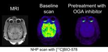 Development of a PET Tracer for OGA with Improved Kinetics in the Living Brain