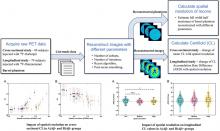 Impact of PET Reconstruction on Amyloid-β Quantitation in Cross-Sectional and Longitudinal Analyses