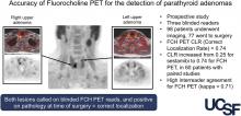 Accuracy of <sup>18</sup>F-Fluorocholine PET for the Detection of Parathyroid Adenomas: Prospective Single-Center Study