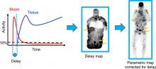 Efficient Delay Correction for Total-Body PET Kinetic Modeling Using Pulse Timing Methods
