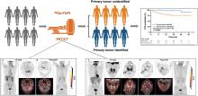 Imaging of Tumor Stroma Using <sup>68</sup>Ga-FAPI PET/CT to Improve Diagnostic Accuracy of Primary Tumors in Head and Neck Cancer of Unknown Primary: A Comparative Imaging Trial