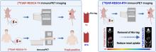 Immuno-PET/CT Imaging of Trop2 with [<sup>18</sup>F]AlF-RESCA-T4 Differentiates Lung Cancer from Inflammation