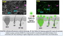 Combined PARP1-Targeted Nuclear Contrast and Reflectance Contrast Enhance Confocal Microscopic Detection of Basal Cell Carcinoma