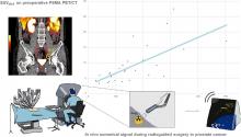 Strong Correlation Between SUV<sub>max</sub> on PSMA PET/CT and Numeric Drop-In γ-Probe Signal for Intraoperative Identification of Prostate Cancer Lesions