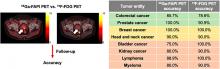 Diagnostic Accuracy of <sup>68</sup>Ga-FAPI Versus <sup>18</sup>F-FDG PET in Patients with Various Malignancies