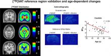 PET Quantification of [<sup>18</sup>F]VAT in Human Brain and Its Test–Retest Reproducibility and Age Dependence