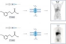 Efficacy and Safety of <sup>124</sup>I-MIBG Dosimetry-Guided High-Activity <sup>131</sup>I-MIBG Therapy of Advanced Pheochromocytoma or Neuroblastoma