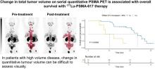 The Prognostic Value of Posttreatment <sup>68</sup>Ga-PSMA-11 PET/CT and <sup>18</sup>F-FDG PET/CT in Metastatic Castration-Resistant Prostate Cancer Treated with <sup>177</sup>Lu-PSMA-617 and NOX66 in a Phase I/II Trial (LuPIN)