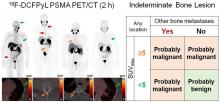 Predicting Outcomes of Indeterminate Bone Lesions on <sup>18</sup>F-DCFPyL PSMA PET/CT Scans in the Setting of High-Risk Primary or Recurrent Prostate Cancer