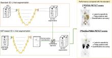 The Use of Maximum-Intensity Projections and Deep Learning Adds Value to the Fully Automatic Segmentation of Lesions Avid for [<sup>18</sup>F]FDG and [<sup>68</sup>Ga]Ga-PSMA in PET/CT