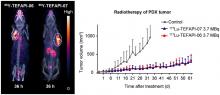 Albumin Binder–Conjugated Fibroblast Activation Protein Inhibitor Radiopharmaceuticals for Cancer Therapy