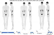 
    Whole-Body Parametric Imaging of <sup>18</sup>F-FDG PET Using uEXPLORER with Reduced Scanning Time
  