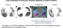 Lung Scintigraphy for Pulmonary Embolism Diagnosis in COVID-19 Patients: A Multicenter Study