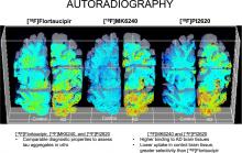 Comparison Between Brain and Cerebellar Autoradiography Using [<sup>18</sup>F]Flortaucipir, [<sup>18</sup>F]MK6240, and [<sup>18</sup>F]PI2620 in Postmortem Human Brain Tissue