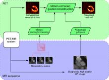 MRI-Guided Motion-Corrected PET Image Reconstruction for Cardiac PET/MRI