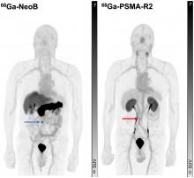 Prospective Comparison of <sup>68</sup>Ga-NeoB and <sup>68</sup>Ga-PSMA-R2 PET/MRI in Patients with Biochemically Recurrent Prostate Cancer