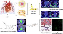 Targeting Fibroblast Activation Protein for Molecular Imaging of Fibrotic Remodeling in Pulmonary Arterial Hypertension