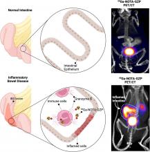 Granzyme B PET Imaging for Assessment of Disease Activity in Inflammatory Bowel Disease