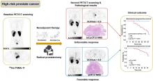 The Association Between [<sup>68</sup>Ga]PSMA PET/CT Response and Biochemical Progression in Patients with High-Risk Prostate Cancer Receiving Neoadjuvant Therapy